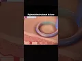 Fix Pigmentation Fast with Laser Read the full description for more