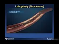 Current status of Lesion Modification Dr Jeffrey Moses