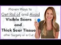 Download Lagu Proven Ways to Heal a Scar Quickly - Avoiding Scar Tissue after Surgery - By a Physical Therapist