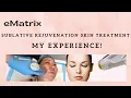 My experience with eMatrix sublative rejuvenation skin resurfacing treatment