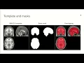 4 0 - MRI Templates and Masks