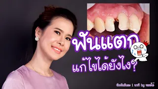 ฟันแตกสามารถรักษาได้ด้วยวิธีใดบ้าง และแต่ละวิธีใช้ในกรณีใด