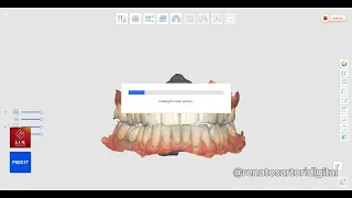Guia para instalação de coroas provisórias ocadas - Medit Temporaries, Medit Design e Medit Splints