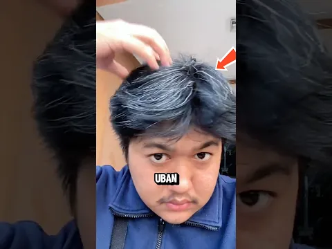 Mencabut Uban Rambut Bisa Berbahaya‼️😱