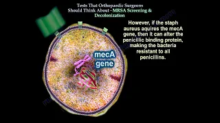 MRSA Carrier Screening and Decolonization Before Surgery