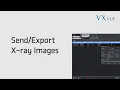 VXvue Quick Guide 05 Send and Export X-ray Image
