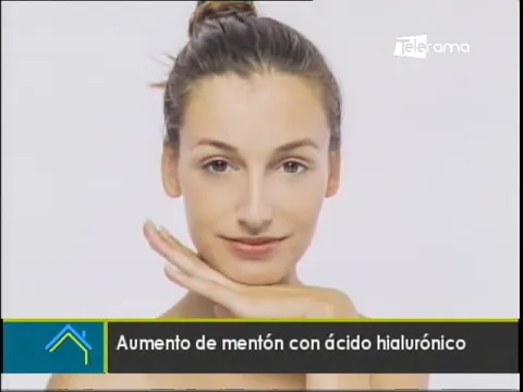 Estética al Día: Aumento de mentón con ácido hialurónico