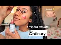The Ordinary Peeling Solution before and after Review 12 weeks