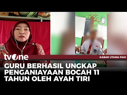 Bocah 11 Tahun Disiksa Ayah Tiri, Dicambuk Rantai, Dipukul Hingga Disundut