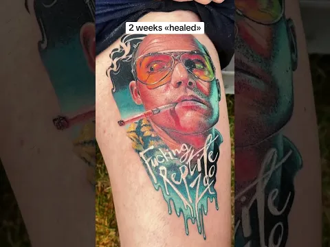 2 weeks «healed», though it’s not completely healed and «set» until 3 months, so stay tuned to see