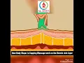 How Cupping massage works our body skin layers