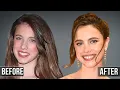 Download Lagu I Was Wrong About Margaret Qualley Being Natural; the Plastic Surgery I Missed...