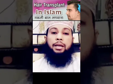 Hair Transplant In Islam by Sikander Warsi | #hairtransformation Ka Masala Jaiz or Najaiz