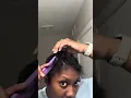 Scratch my scalp with me This is the aftermath when my scalp is inflamed