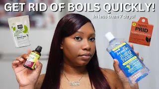 How to Get Rid of Boils FAST Home Remedies Products Aftercare That ACTUALLY Work