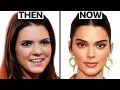 What Happened to Kendall Jenner s Face Plastic Surgery Analysis