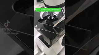 UTI Urinary Tract Infection Under The Microscope 