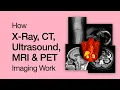 Why X-ray CT Ultrasound MRI PET Imaging Work