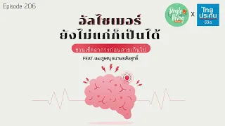 ใครควรพิจารณาตรวจหาอัลไซเมอร์ก่อนมีอาการ