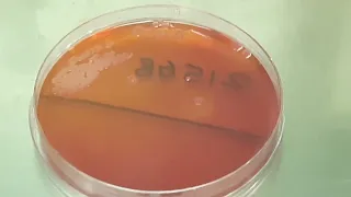 Serratia marcescens colony morphology on MacConkey agar of sputum culture