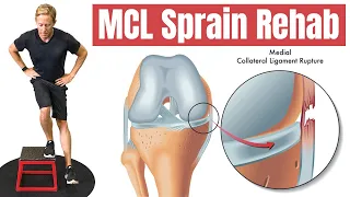 Download MCL Tear - 4 Exercises to Rehab Your Knee MP3