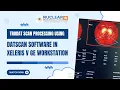 TRODAT Scan Processing Tutorial DaTscan Analysis on Xeleris Workstation GE NM Workflow Guide