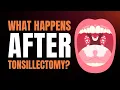 Tonsillectomy Recovery - What To Expect After Surgery