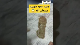 اول مره اشوف طفل عمره شهرين في بطن أمه 