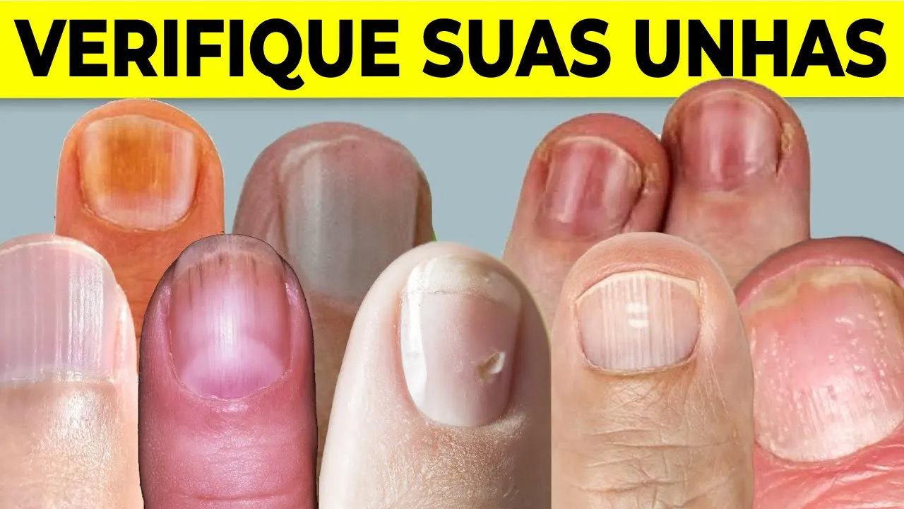 8 Coisas que suas UNHAS Podem Dizer Sobre sua Saúde