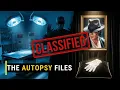 Michael Jackson s Autopsy Report - Shocking Details Doctors Hid