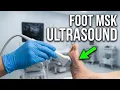 MSK Ultrasound - Foot