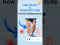 Download Lagu Shin Splints vs. Stress Fracture #physicaltherapy #physiotheraphy #shinsplints
