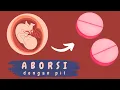 Download Lagu ABORSI? | #KOMMA