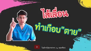 ไส้เลื่อนขาหนีบคืออะไร และเกิดขึ้นได้ที่ไหนบ้างในร่างกาย