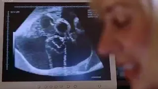the magic baby protected his father