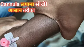 How to insert a cannula step by step?, cannula kaise लगाये?, iv cannula, intravenous cannulation