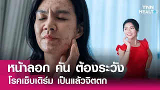 สาเหตุของโรคเซบเดิมเกิดจากอะไรบ้าง