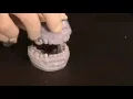 NTI-tss Plus - Overbite