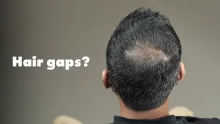 I Fixed My Patchy Beard & Grey Hair In 3 Seconds 😳 (This Actually Works)