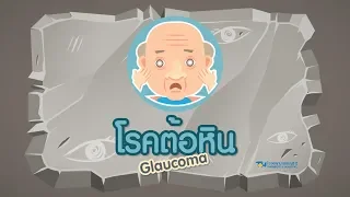 โรคต้อหินคืออะไร และส่งผลต่อการมองเห็นอย่างไร
