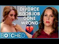 Jennifer s Post-Divorce Boob Job Left Her With Spaghetti Squash Breasts Botched E