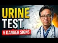 Urine Test Explained What Your Results Really Mean