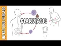 Giardiasis - Giardia Lamblia (Giardia intestinalis, Giardia duodenalis) infection
