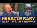 Doctors Successfully Operate on Baby Still in the Womb in Pioneering Surgery EWTN News Nightly