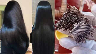 سر من الاسرار الشعبية القديمة من الثرات المغربي لعلاج الصلع وتكثيف الشعر وتطويله بسرعة بشوك القنفد 