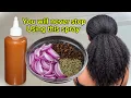 Mix Onions Cloves and Rosemary for Skyrocket Hair growth