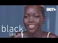 This Viral Model Sensation Wanted to Bleach Her Skin to Fit In Black Like Me