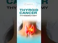 Can You Choose the Right CPT Thyroid Cancer Coding Guide