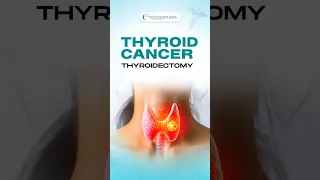 Can You Choose the Right CPT Thyroid Cancer Coding Guide
