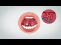 How to use WaferiX (sublingual wafer)